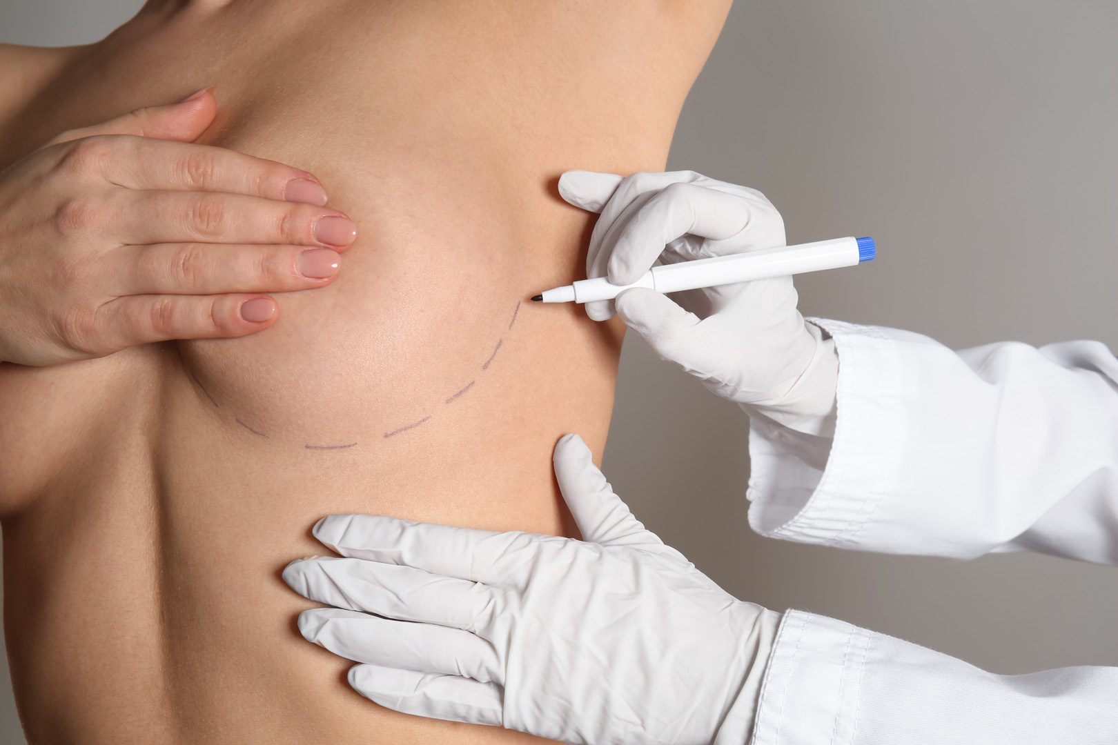 Surgeon preparing for breast augmentation